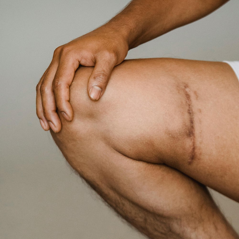 Are you disappointed with the results following surgery?