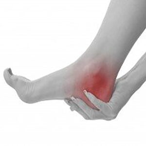 Are you suffering from Plantar fasciitis (AKA heel pain)?